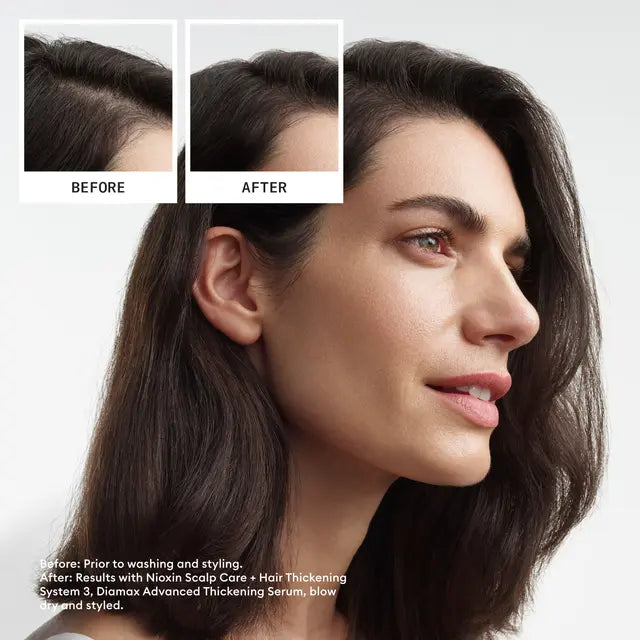 Nioxin Scalp + Hair Thickening System 3 Trio Pack LIGHT THINNING  COLOURED / DRY / DAMAGED HAIR